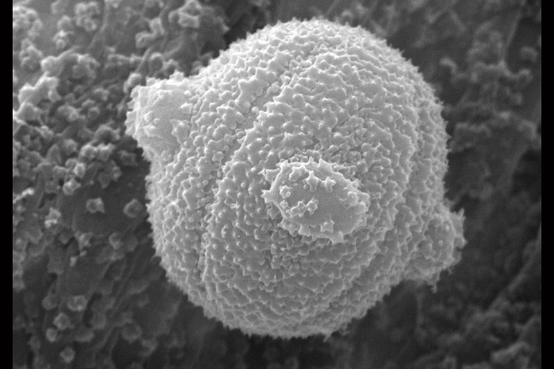 A black and white image of a microscopic ball.