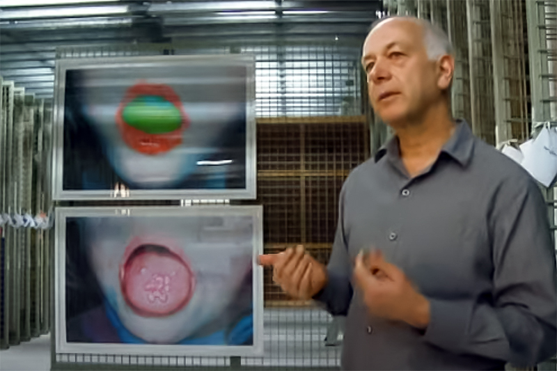 A man in a grey shirt is standing in front of two large photographs of children's open mouths. One of the mouths has something bright green in it. The oher is sticking out it's tongue and has something pink on it.